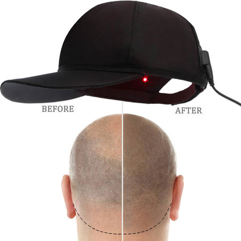 ApolloCap™ Red Light Therapy Cap for Hair Growth